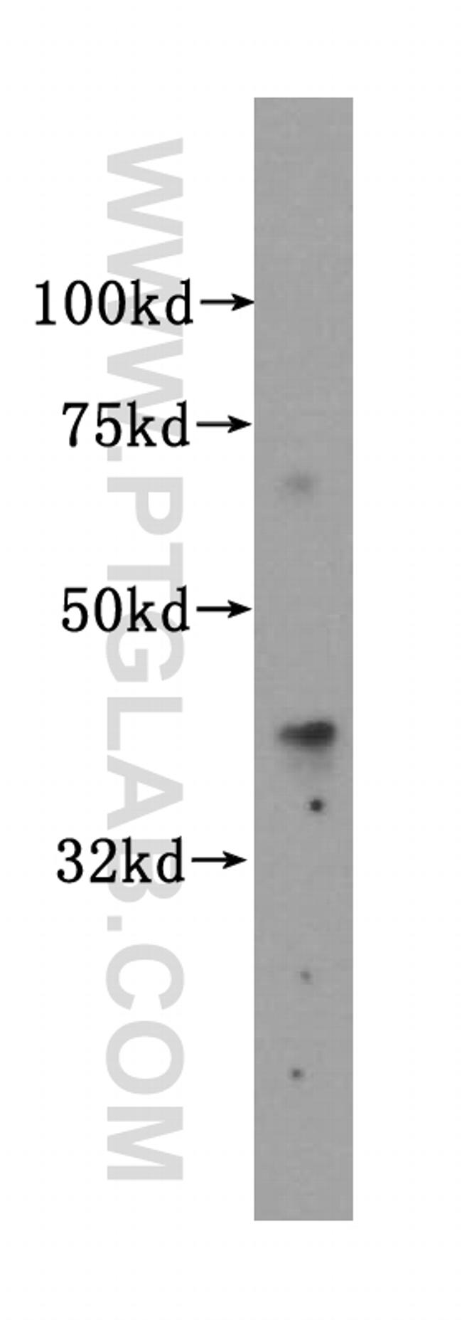 Islet 1 Antibody in Western Blot (WB)