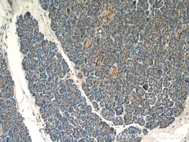 Islet 1 Antibody in Immunohistochemistry (Paraffin) (IHC (P))