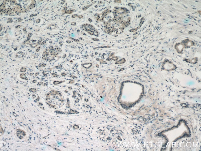 Islet 1 Antibody in Immunohistochemistry (Paraffin) (IHC (P))