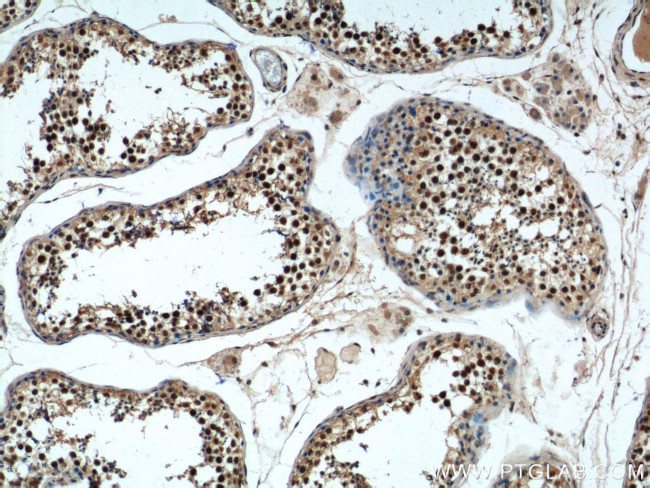 NRIP3 Antibody in Immunohistochemistry (Paraffin) (IHC (P))