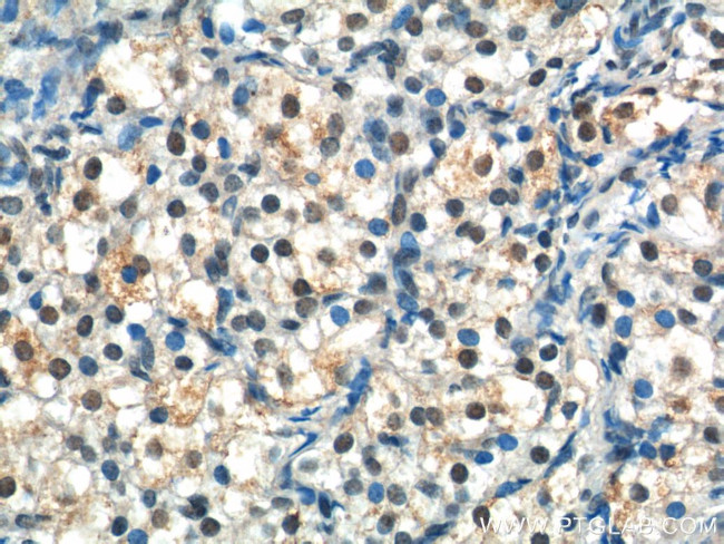 NRIP3 Antibody in Immunohistochemistry (Paraffin) (IHC (P))