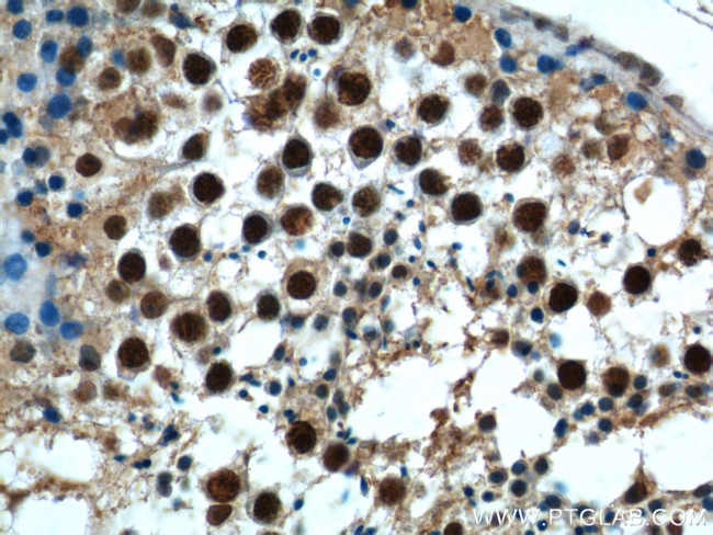 NRIP3 Antibody in Immunohistochemistry (Paraffin) (IHC (P))