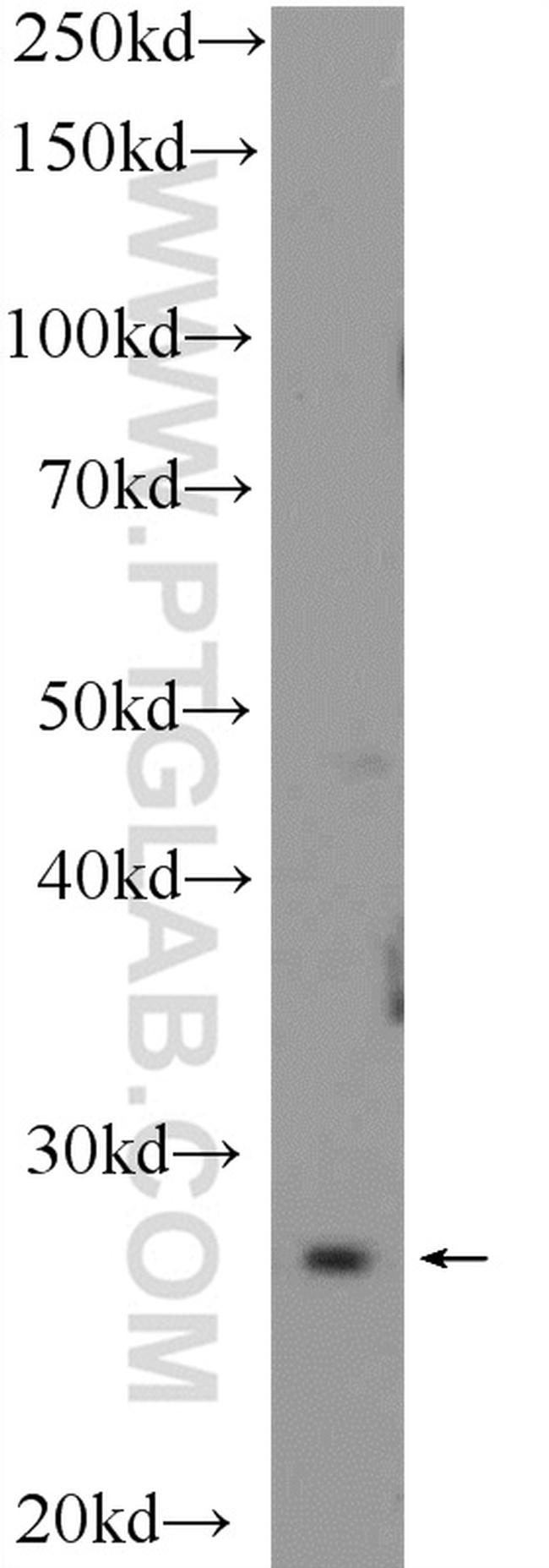 NRIP3 Antibody in Western Blot (WB)