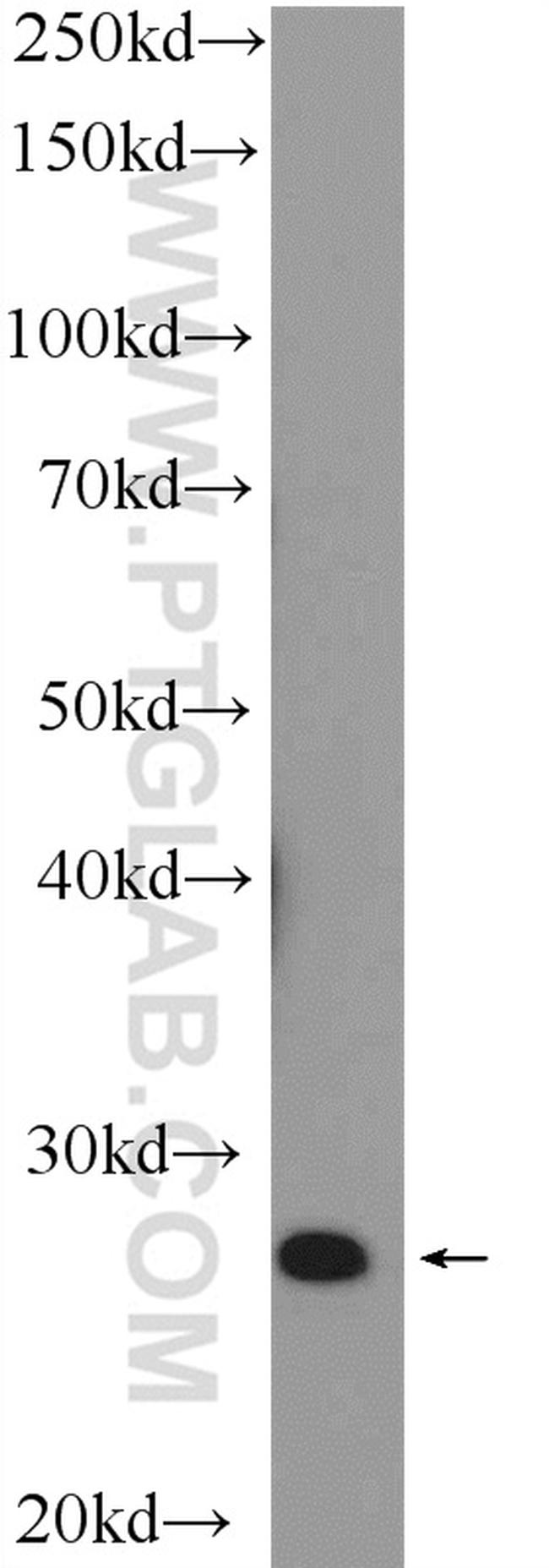 NRIP3 Antibody in Western Blot (WB)