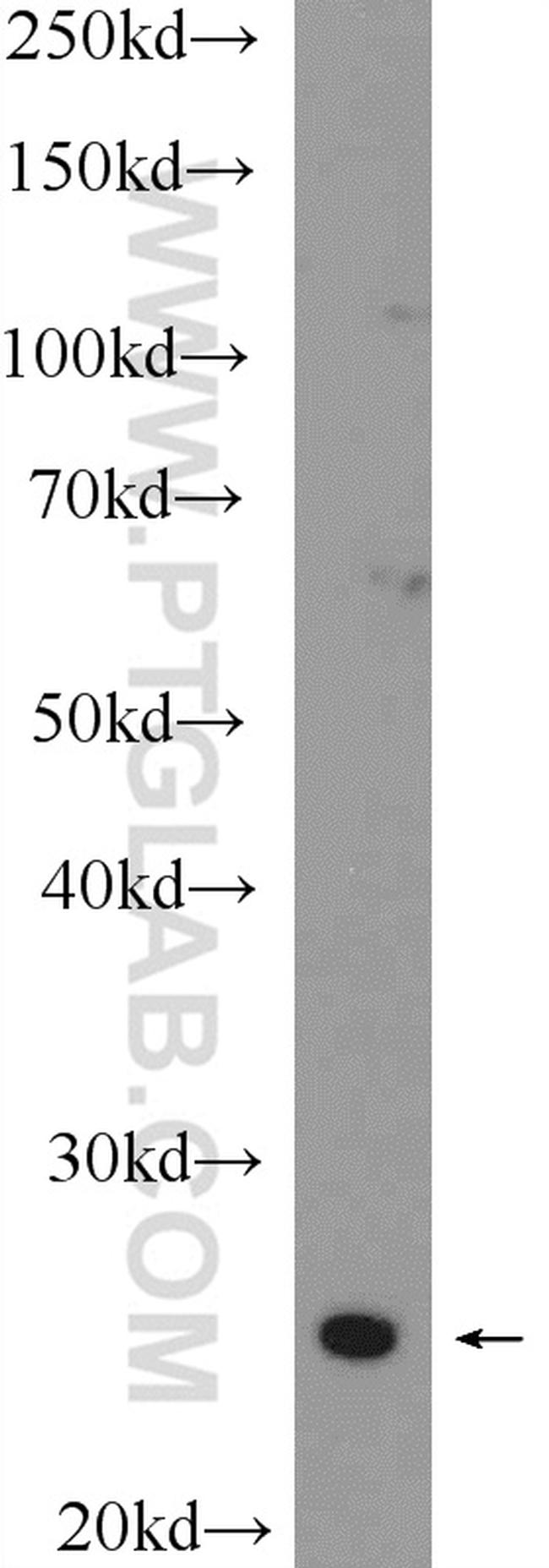 NRIP3 Antibody in Western Blot (WB)