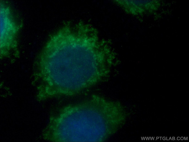 SYNJ2BP Antibody in Immunocytochemistry (ICC/IF)