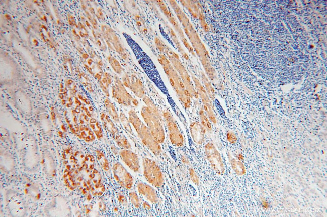 SYNJ2BP Antibody in Immunohistochemistry (Paraffin) (IHC (P))