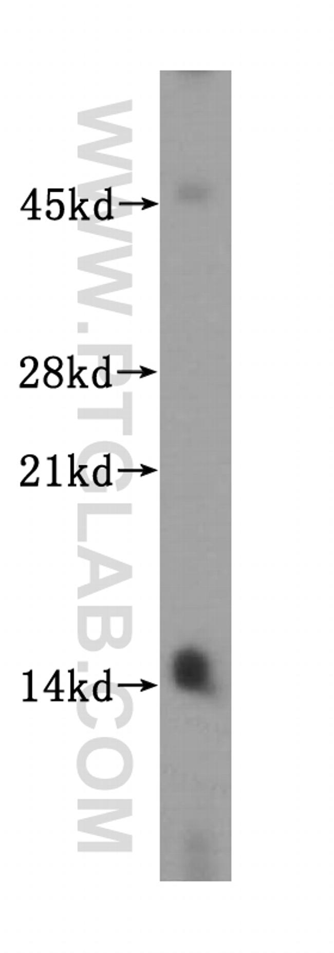 SYNJ2BP Antibody in Western Blot (WB)