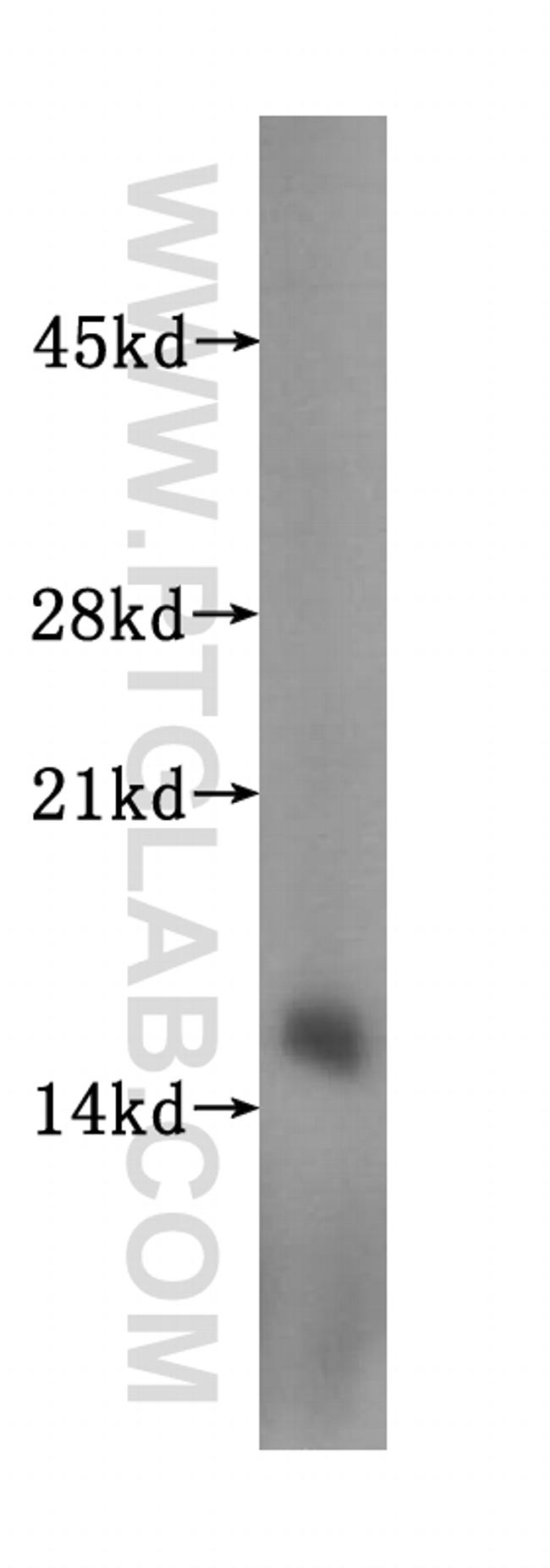 SYNJ2BP Antibody in Western Blot (WB)