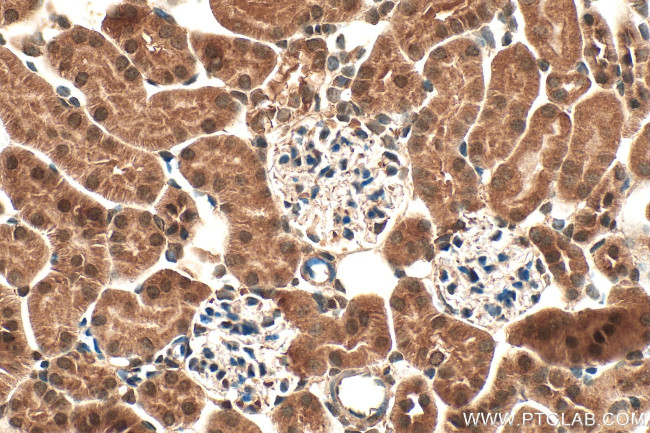 DUSP12 Antibody in Immunohistochemistry (Paraffin) (IHC (P))