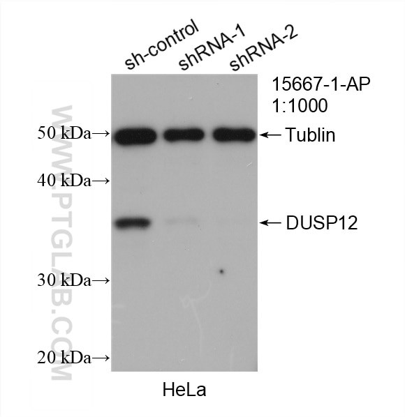 DUSP12 Antibody in Western Blot (WB)