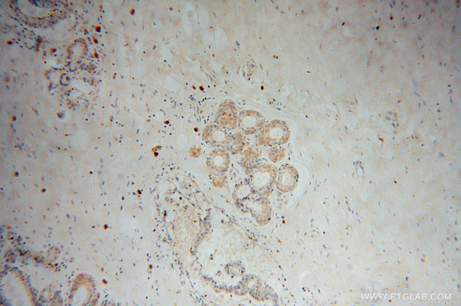 VPS25 Antibody in Immunohistochemistry (Paraffin) (IHC (P))