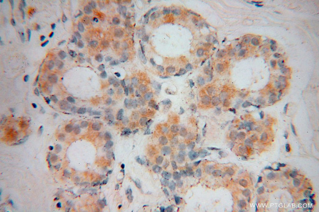 VPS25 Antibody in Immunohistochemistry (Paraffin) (IHC (P))