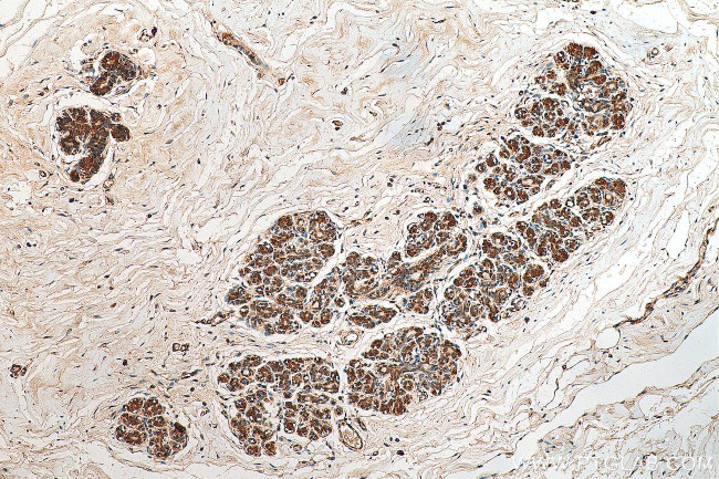 VPS25 Antibody in Immunohistochemistry (Paraffin) (IHC (P))