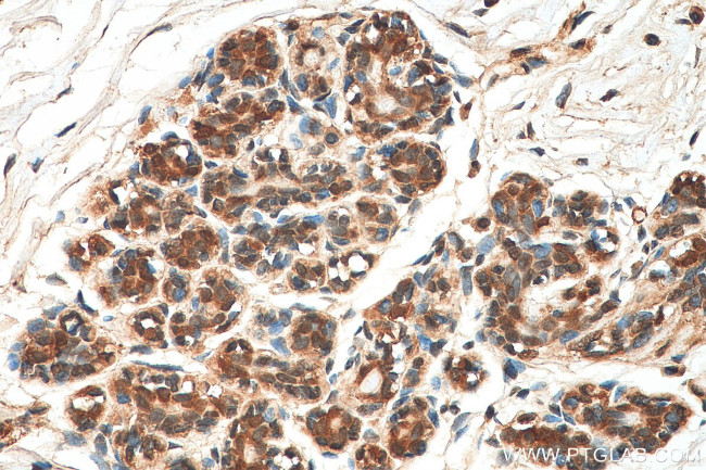 VPS25 Antibody in Immunohistochemistry (Paraffin) (IHC (P))