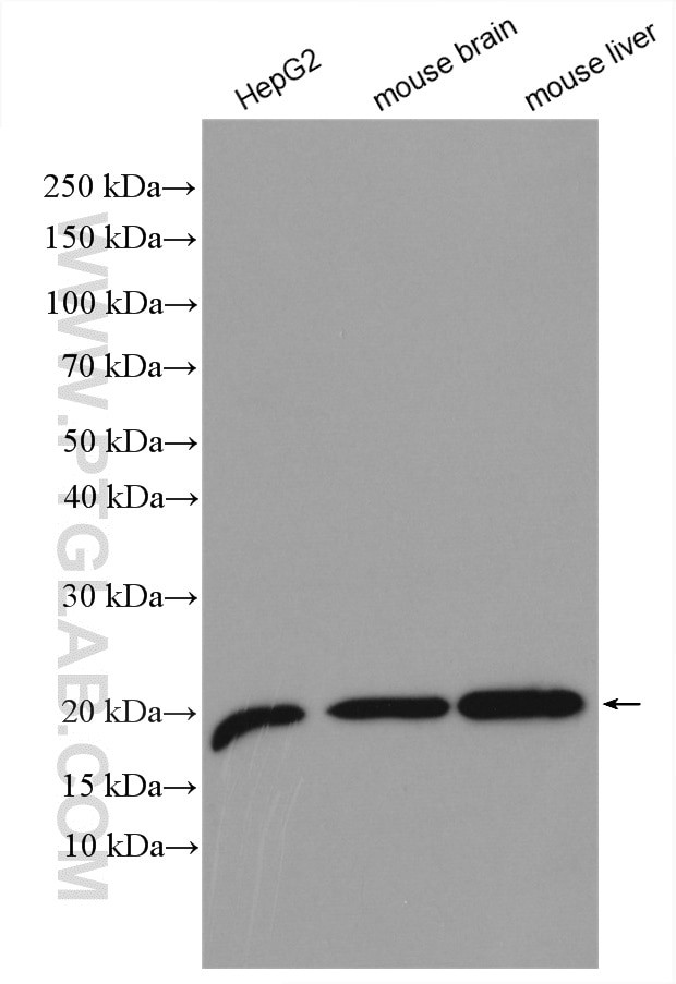 VPS25 Antibody in Western Blot (WB)