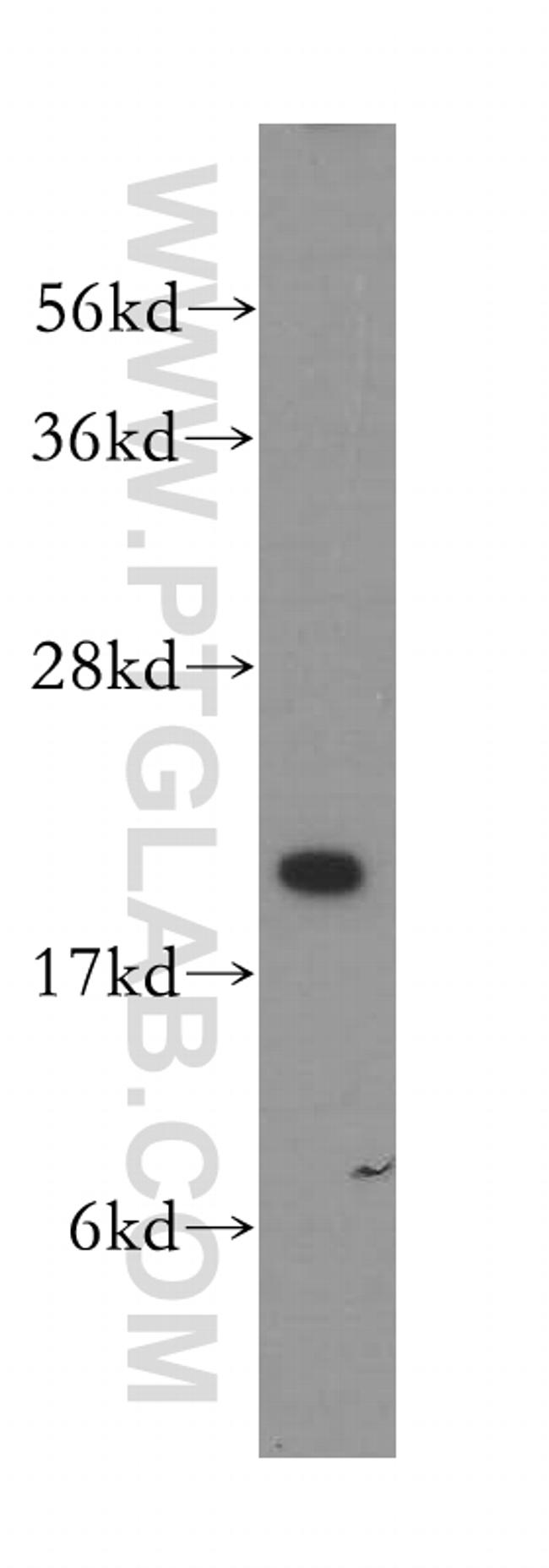 VPS25 Antibody in Western Blot (WB)