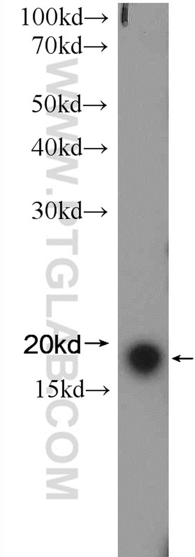 VPS25 Antibody in Western Blot (WB)