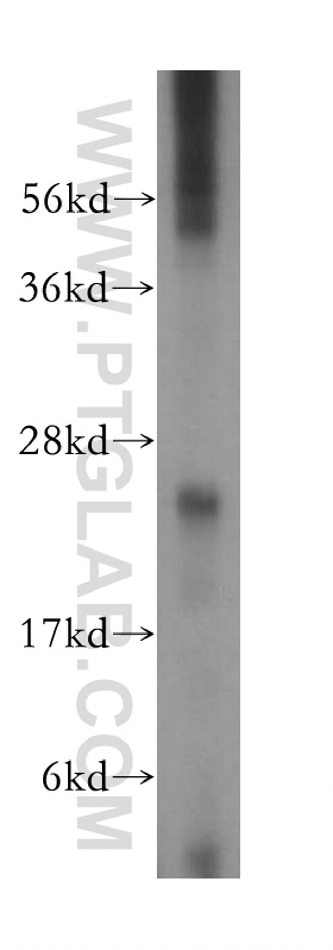 ARD1B Antibody in Western Blot (WB)