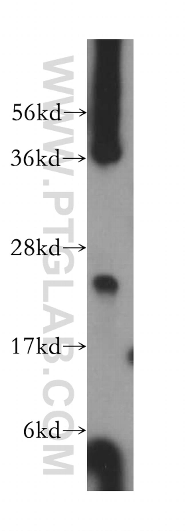 ARD1B Antibody in Western Blot (WB)