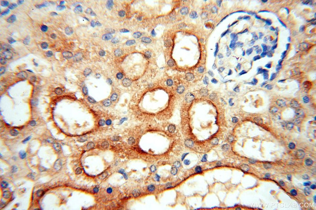 PPIL3 Antibody in Immunohistochemistry (Paraffin) (IHC (P))