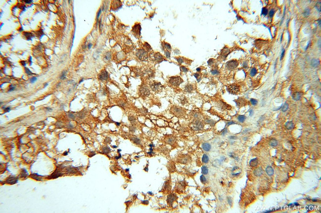 PPIL3 Antibody in Immunohistochemistry (Paraffin) (IHC (P))