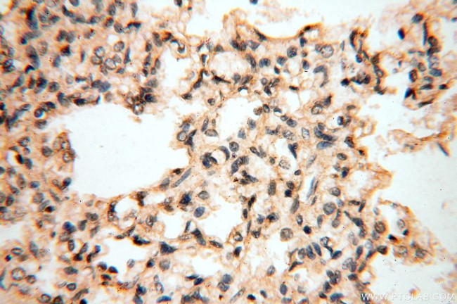 PPIL3 Antibody in Immunohistochemistry (Paraffin) (IHC (P))