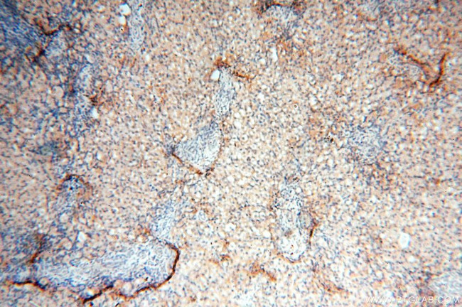 PPIL3 Antibody in Immunohistochemistry (Paraffin) (IHC (P))