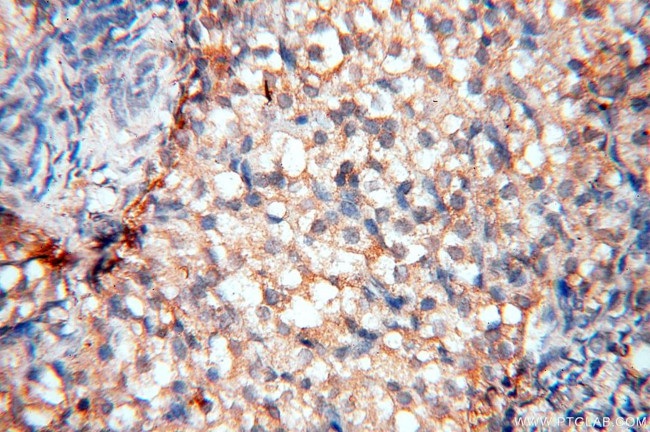 PPIL3 Antibody in Immunohistochemistry (Paraffin) (IHC (P))