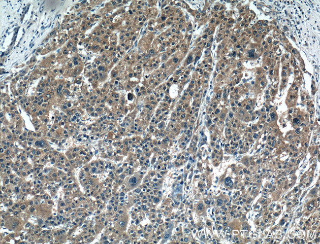 PMVK Antibody in Immunohistochemistry (Paraffin) (IHC (P))