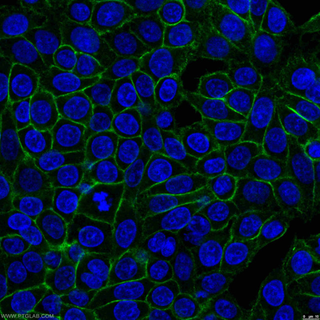 CD44 Antibody in Immunocytochemistry (ICC/IF)