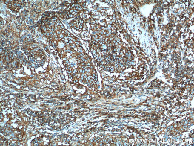 CD44 Antibody in Immunohistochemistry (Paraffin) (IHC (P))