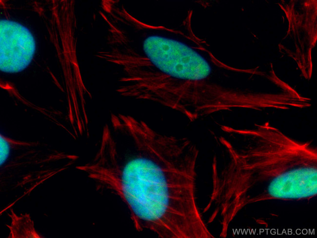 HEXIM1 Antibody in Immunocytochemistry (ICC/IF)