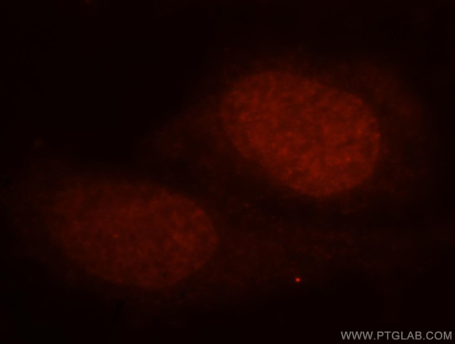 HEXIM1 Antibody in Immunocytochemistry (ICC/IF)