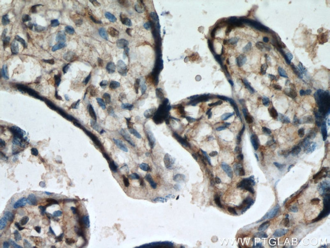 HEXIM1 Antibody in Immunohistochemistry (Paraffin) (IHC (P))