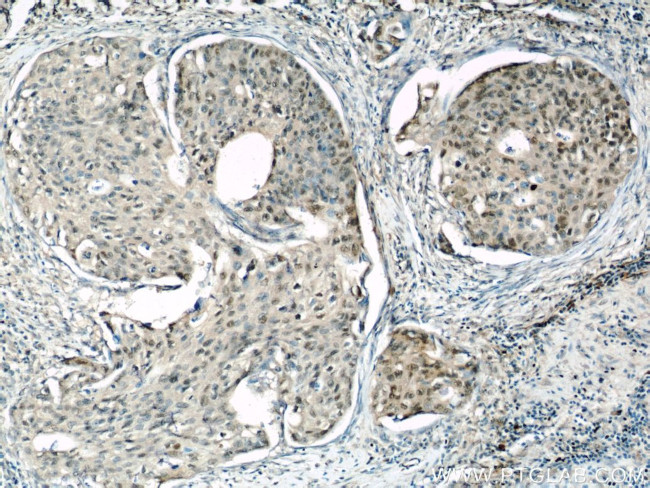 HEXIM1 Antibody in Immunohistochemistry (Paraffin) (IHC (P))