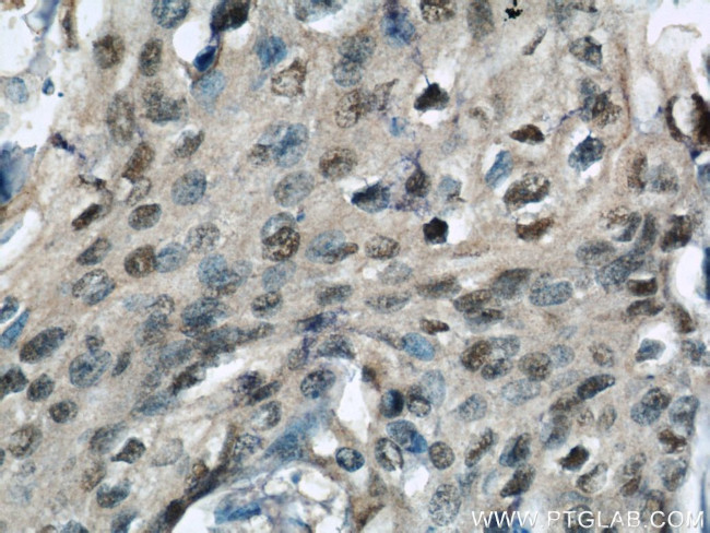 HEXIM1 Antibody in Immunohistochemistry (Paraffin) (IHC (P))