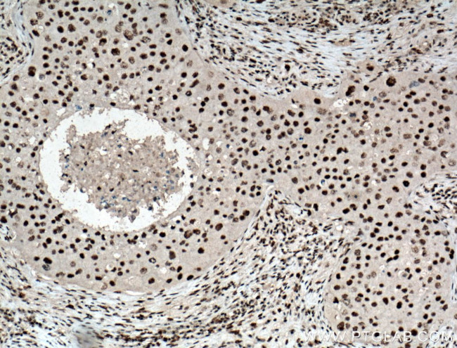 HEXIM1 Antibody in Immunohistochemistry (Paraffin) (IHC (P))