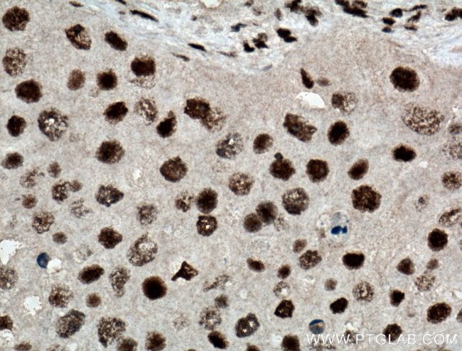 HEXIM1 Antibody in Immunohistochemistry (Paraffin) (IHC (P))