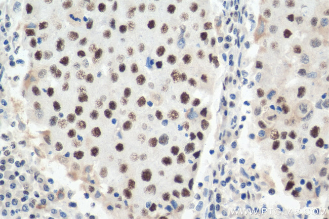 HEXIM1 Antibody in Immunohistochemistry (Paraffin) (IHC (P))