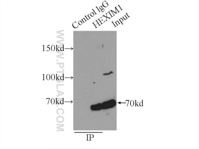 HEXIM1 Antibody in Immunoprecipitation (IP)