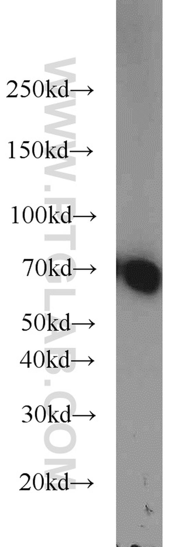 HEXIM1 Antibody in Western Blot (WB)