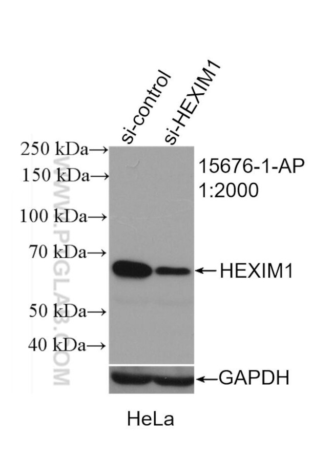 HEXIM1 Antibody in Western Blot (WB)