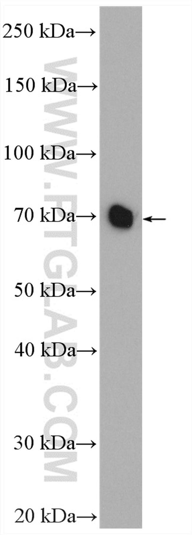 HEXIM1 Antibody in Western Blot (WB)