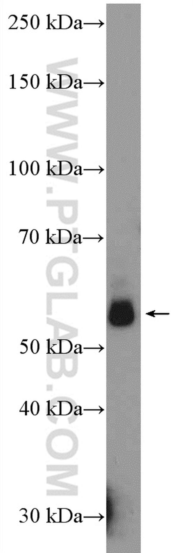 HEXIM1 Antibody in Western Blot (WB)