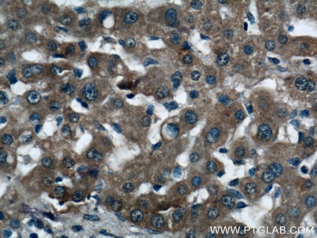 KHK Antibody in Immunohistochemistry (Paraffin) (IHC (P))