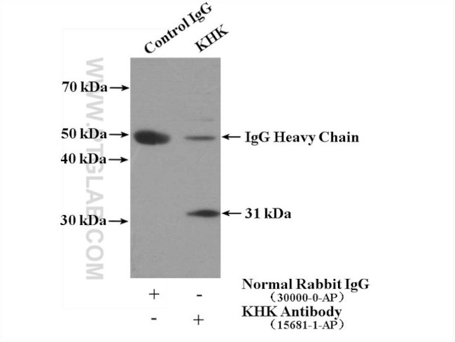 KHK Antibody in Immunoprecipitation (IP)