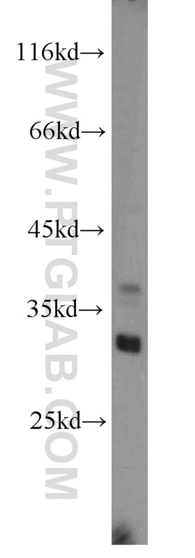 KHK Antibody in Western Blot (WB)