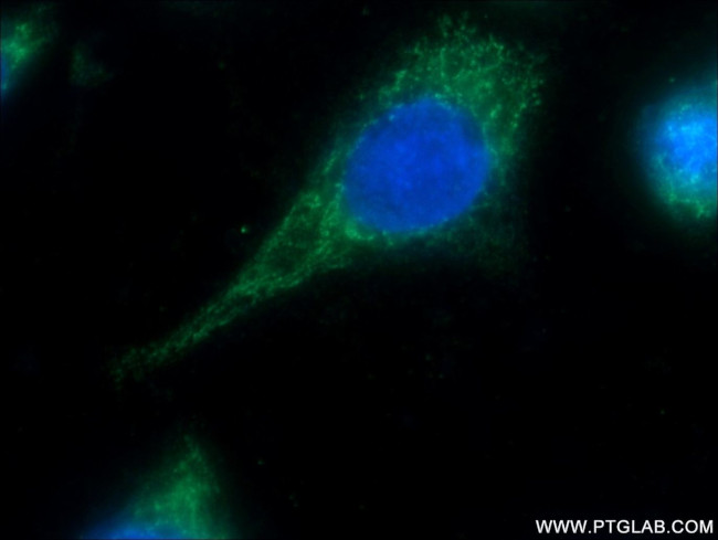 MRPL45 Antibody in Immunocytochemistry (ICC/IF)