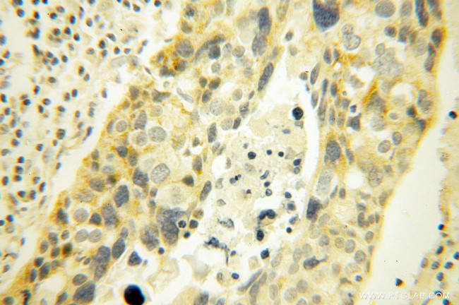 MRPL45 Antibody in Immunohistochemistry (Paraffin) (IHC (P))